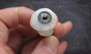 Artificial Eye Implantation