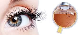 Vitrio Retina Surgery